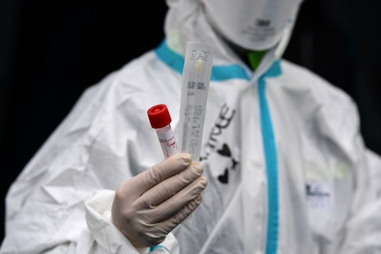  Vaksina “Zvicerane” kundër koronavirusit testohet te minjtë