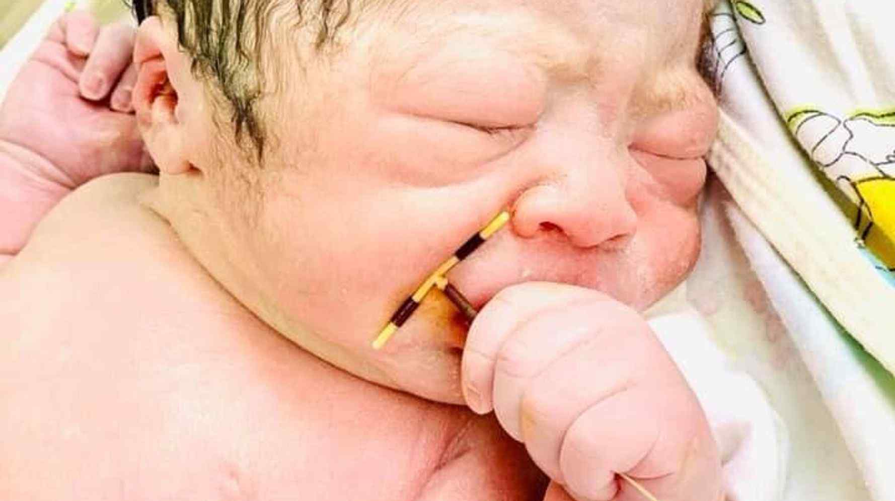  Nëna e kishte vendosur për të mos mbetur shtatzënë, foshnja lind me spiralen në dorë