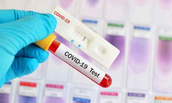  Dy të vdekur dhe 169 të infektuar me koronavirus në Kosovë