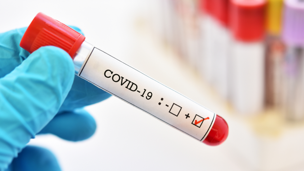  Çmimet për testet COVID te privatët –  Do të mbikëqyren nëse ka keqpërdorime