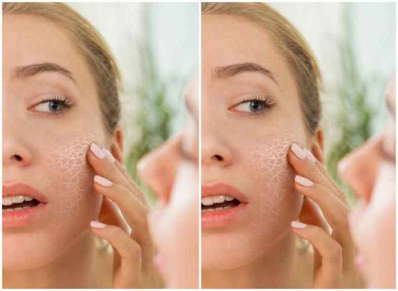  Dermatologët këshillojnë: 5 produkte që s’duhet t’i përdorni nga tetori në shkurt