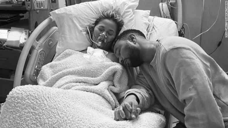  Chrissy Teigen publikon foto të dhimbshme nga momenti i humbjes së fëmijës si pasojë e komplikimeve të shtatzënisë