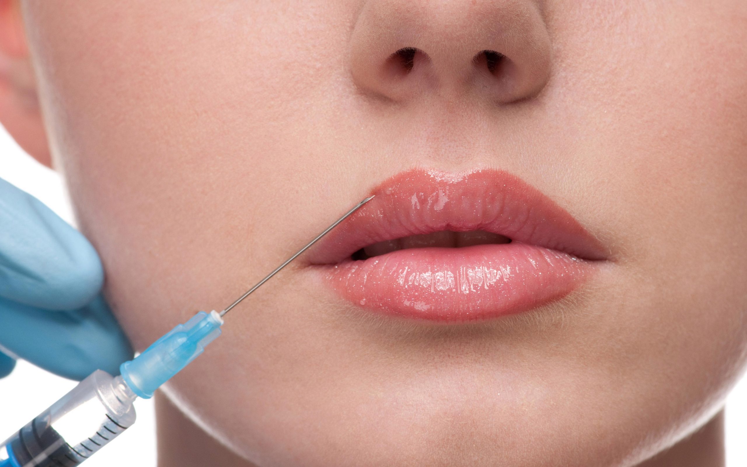  Prindi e dërgon vajzën 13 vjeçare   për t’i bërë buzët botox