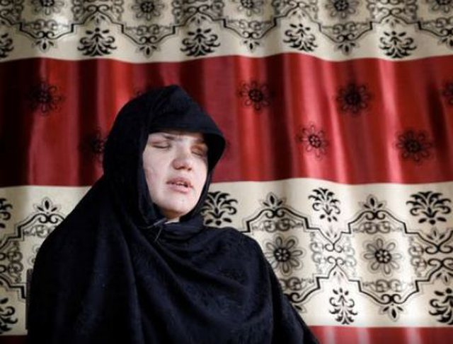  Talibanët i nxorrën sytë kur ishte shtatzënë! Gruaja afgane: Qentë ushqeheshin nga trupi ynë (Foto)