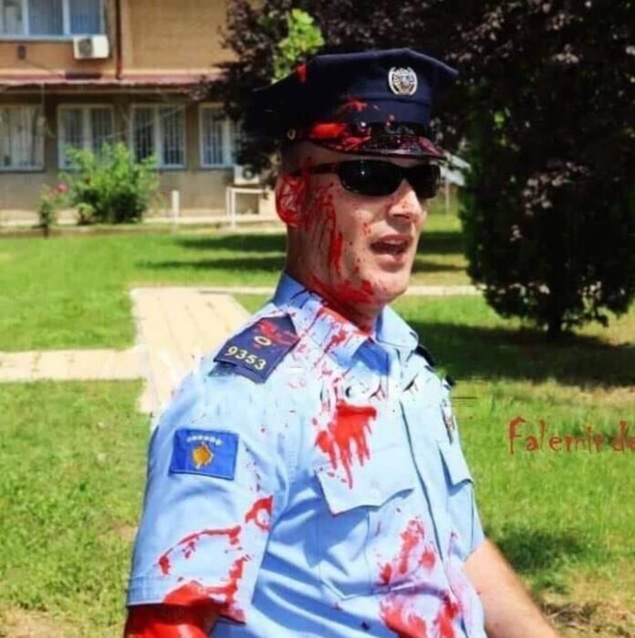  Mesazhi i një polici: Nuk të urrej pse më godite, thjesht jam në shërbimin tuaj
