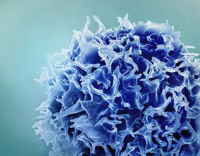  Shëndeti imunitar ka të bëjë me ekuilibrin – Një imunolog shpjegon pse një përgjigje imune shumë e fortë dhe shumë e dobët mund të çojë në sëmundje